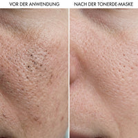 Clay Mask for Pores and Blackheads